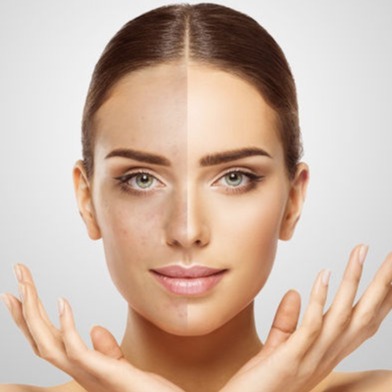 Microneedling | alle Beauty-Kits in der Übersicht